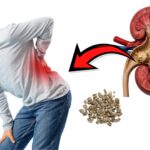 Kidney stone symptoms, cause, and treatment